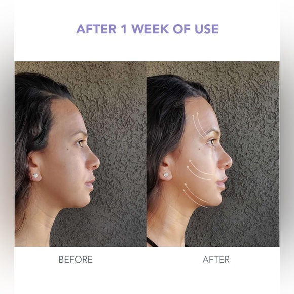 FOREO BEAR Mini Microcurrent Facial Device - Face Sculpting Tool - Picture 2 of 4